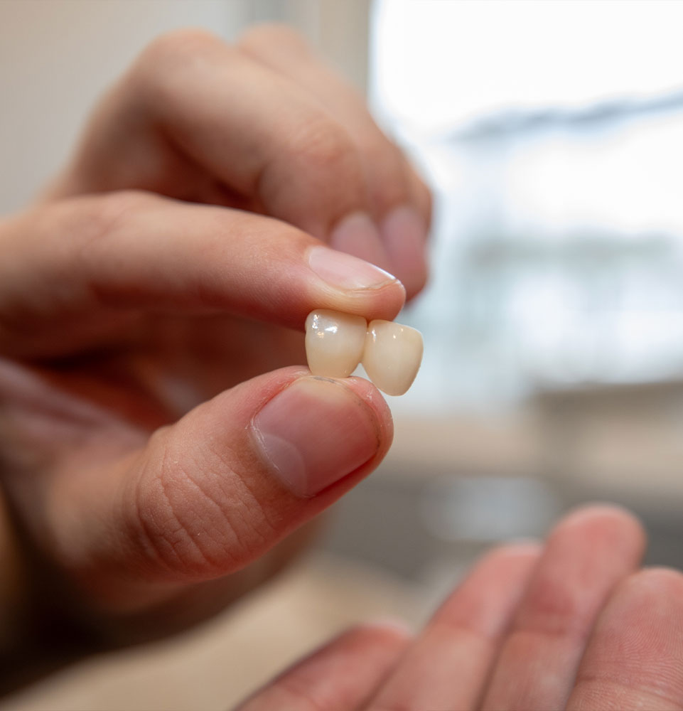 close up of dental bridge within the dental center