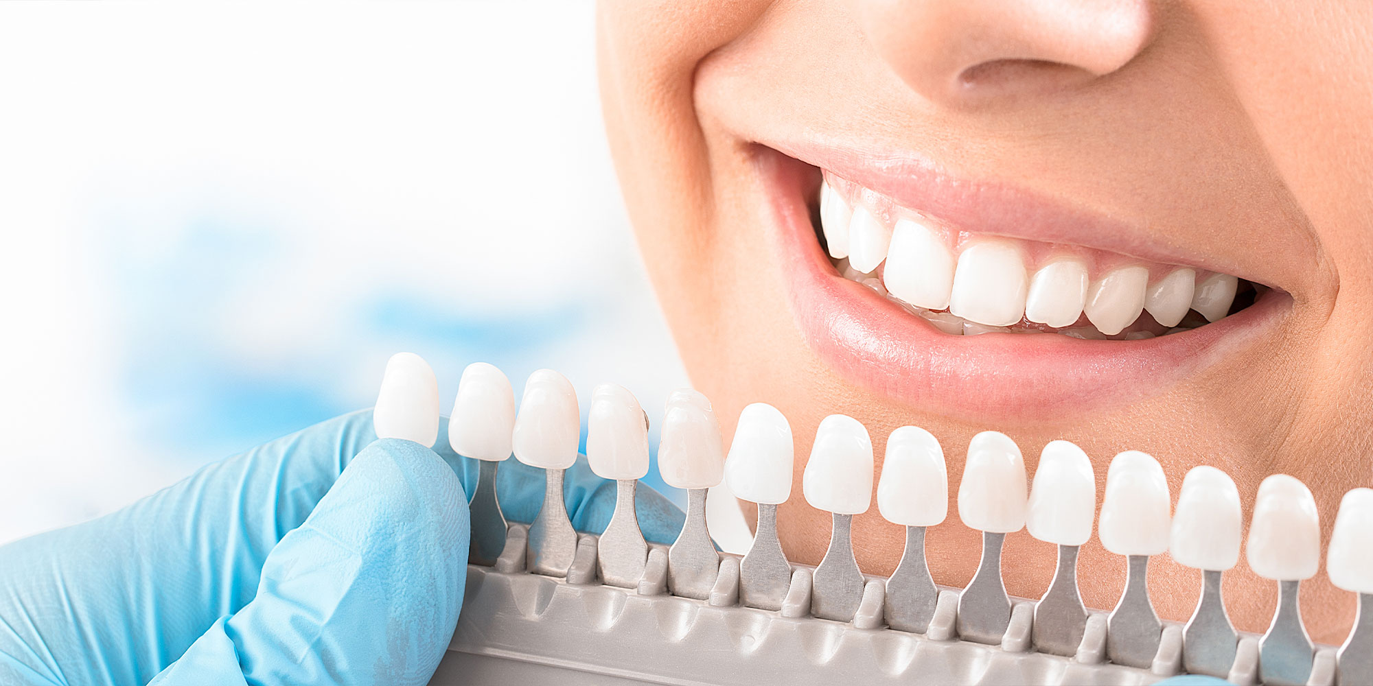 cloe up of patient comparing different scales of teeth whitening
