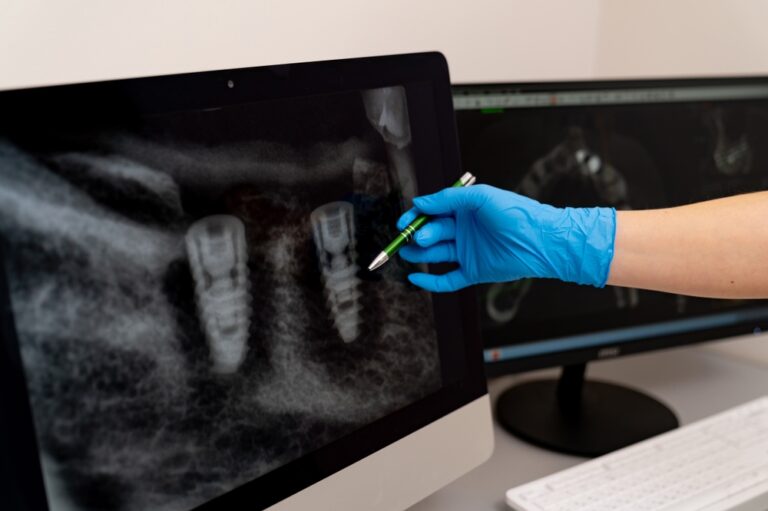 Dentist and patient discussing teeth bonding options