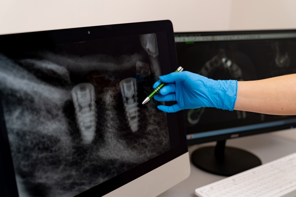 Dentist and patient discussing teeth bonding options