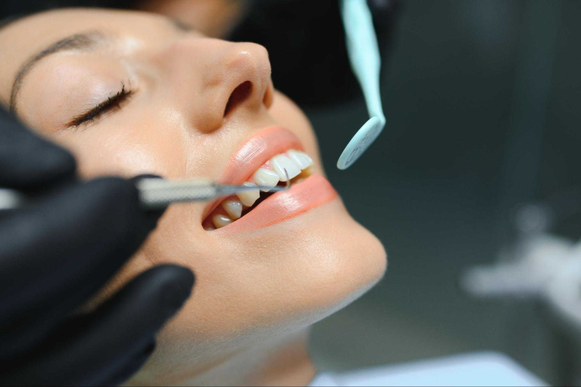 A close-up of a female patient's teeth during a dental crown preparation procedure.