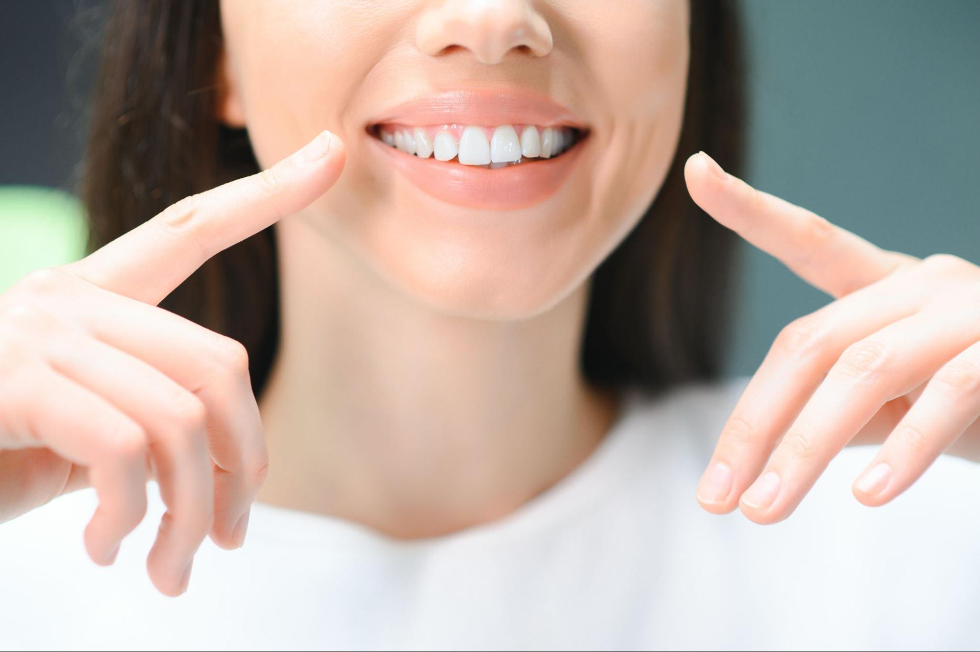 A close-up shot of a beautiful, happy young woman’s perfect white teeth after a deep teeth cleaning treatment