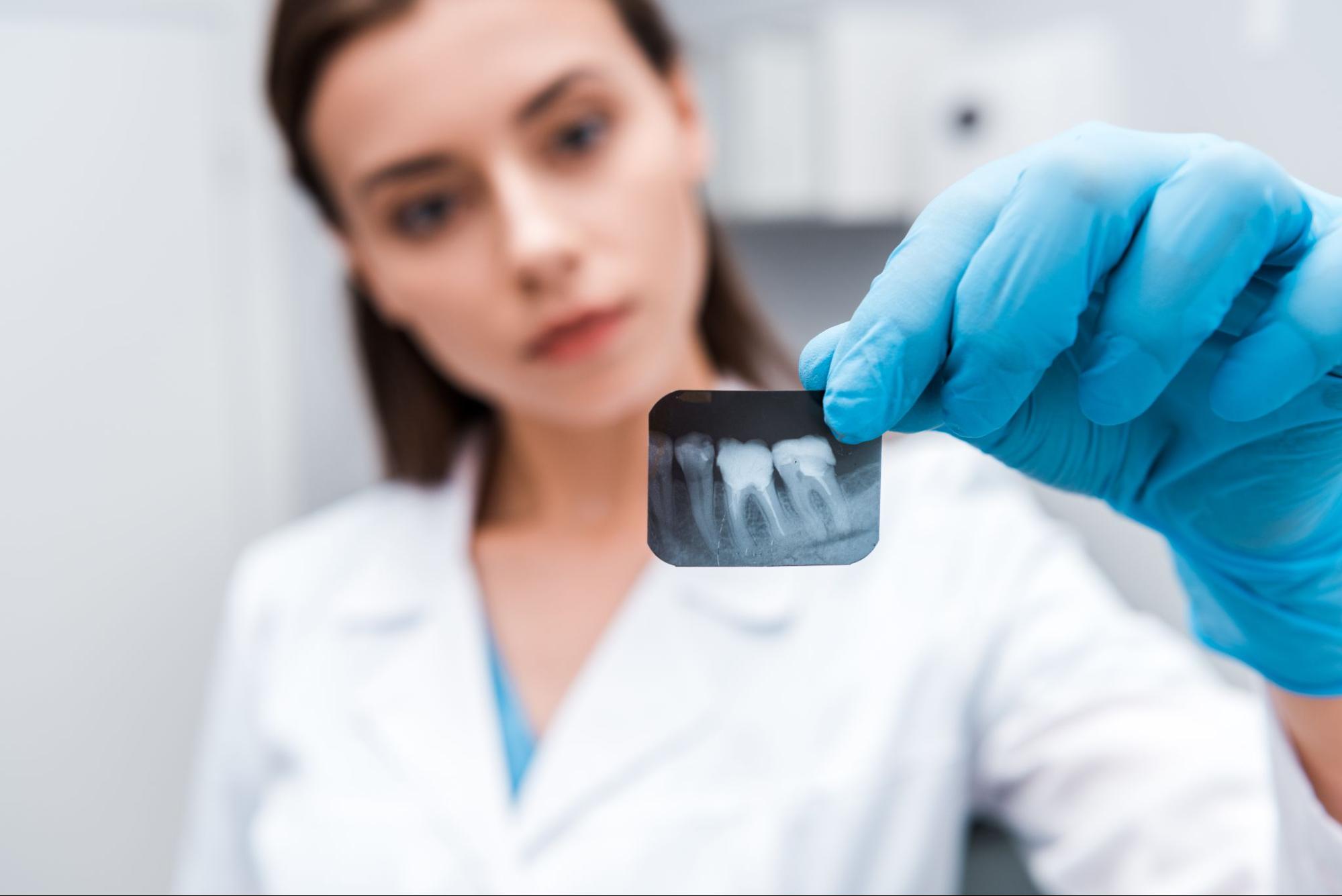 A female dentist examines a periapical teeth X-ray.