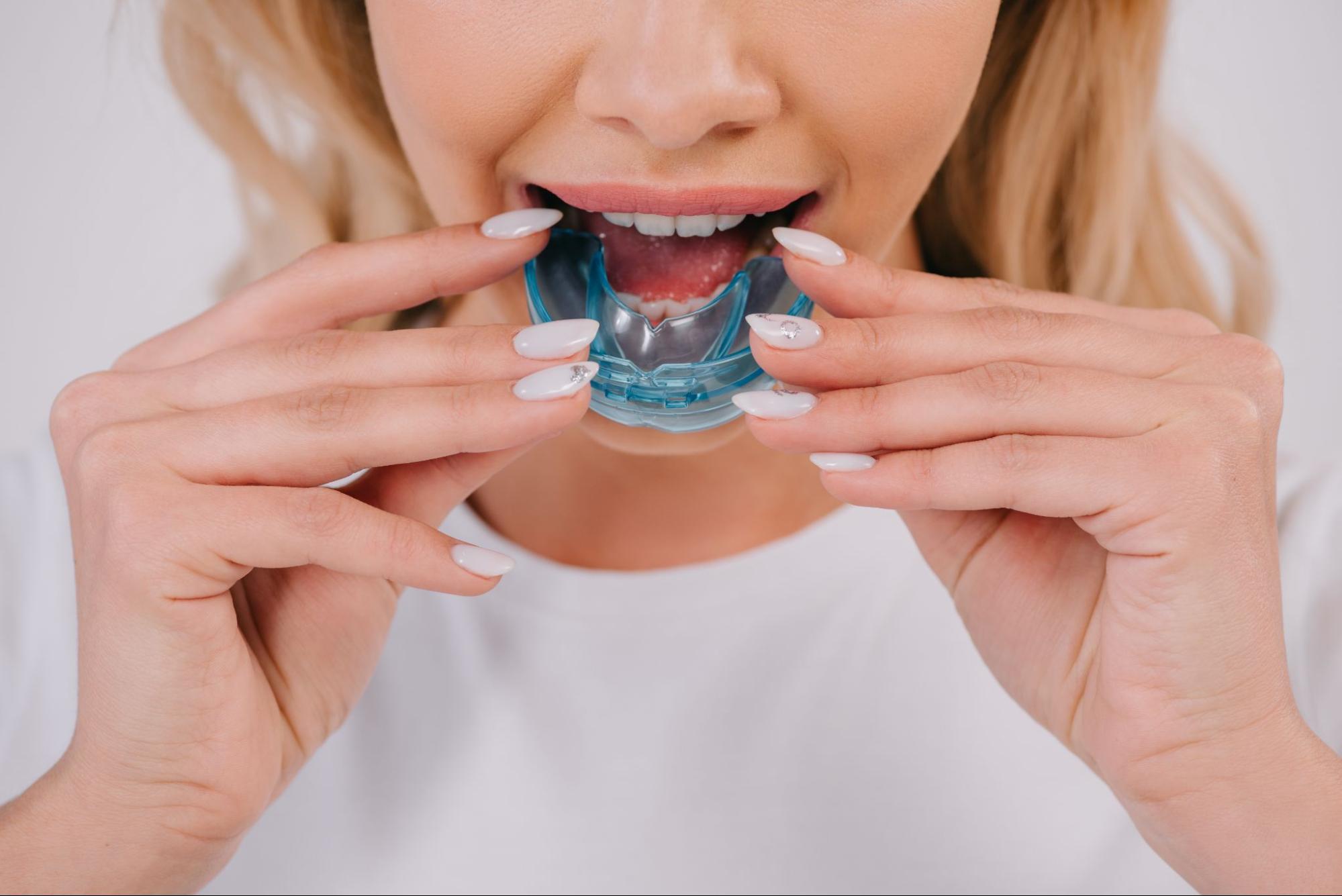 A partial view of a woman putting on a night guard for teeth in her mouth.