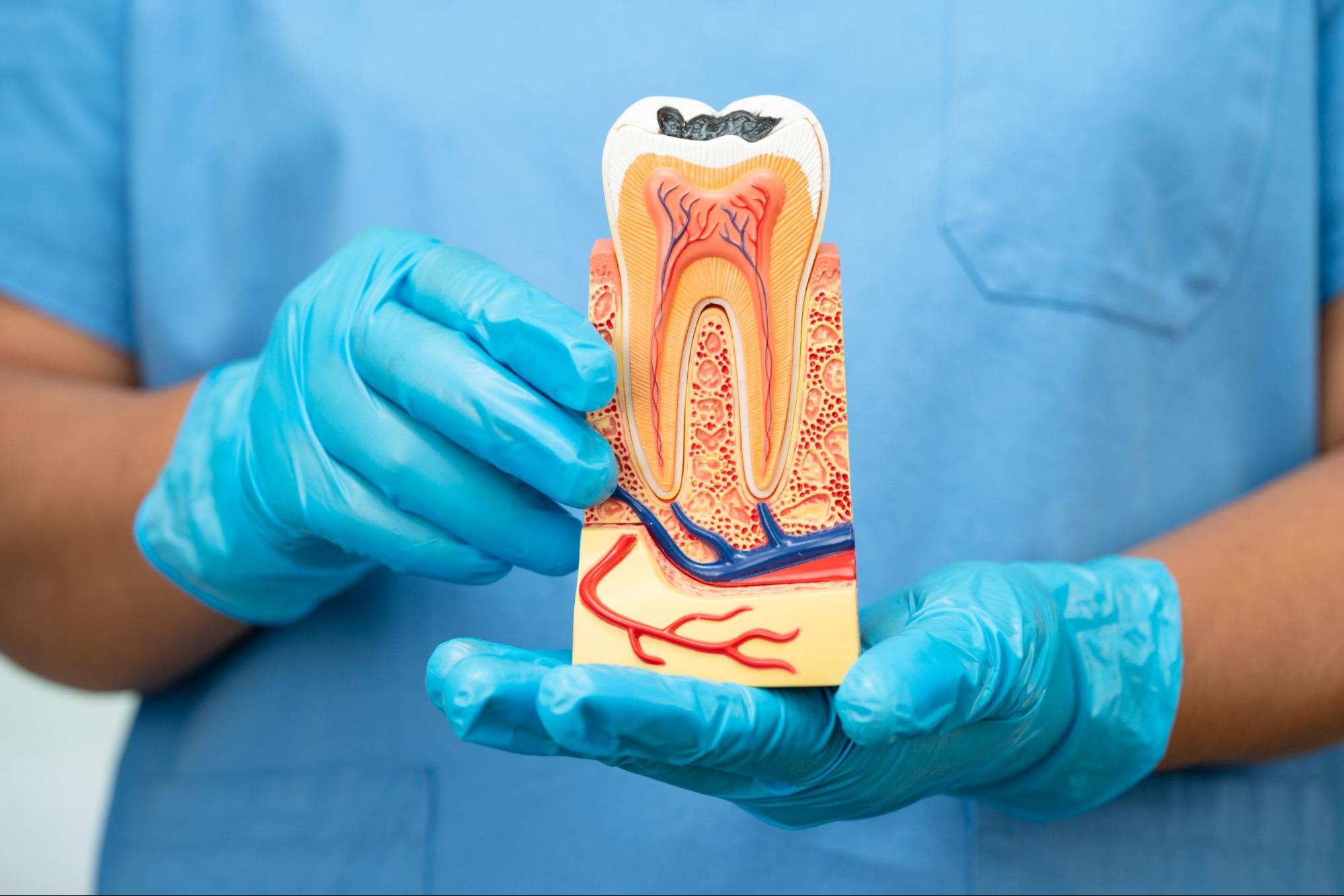 A dentist holds a model tooth.