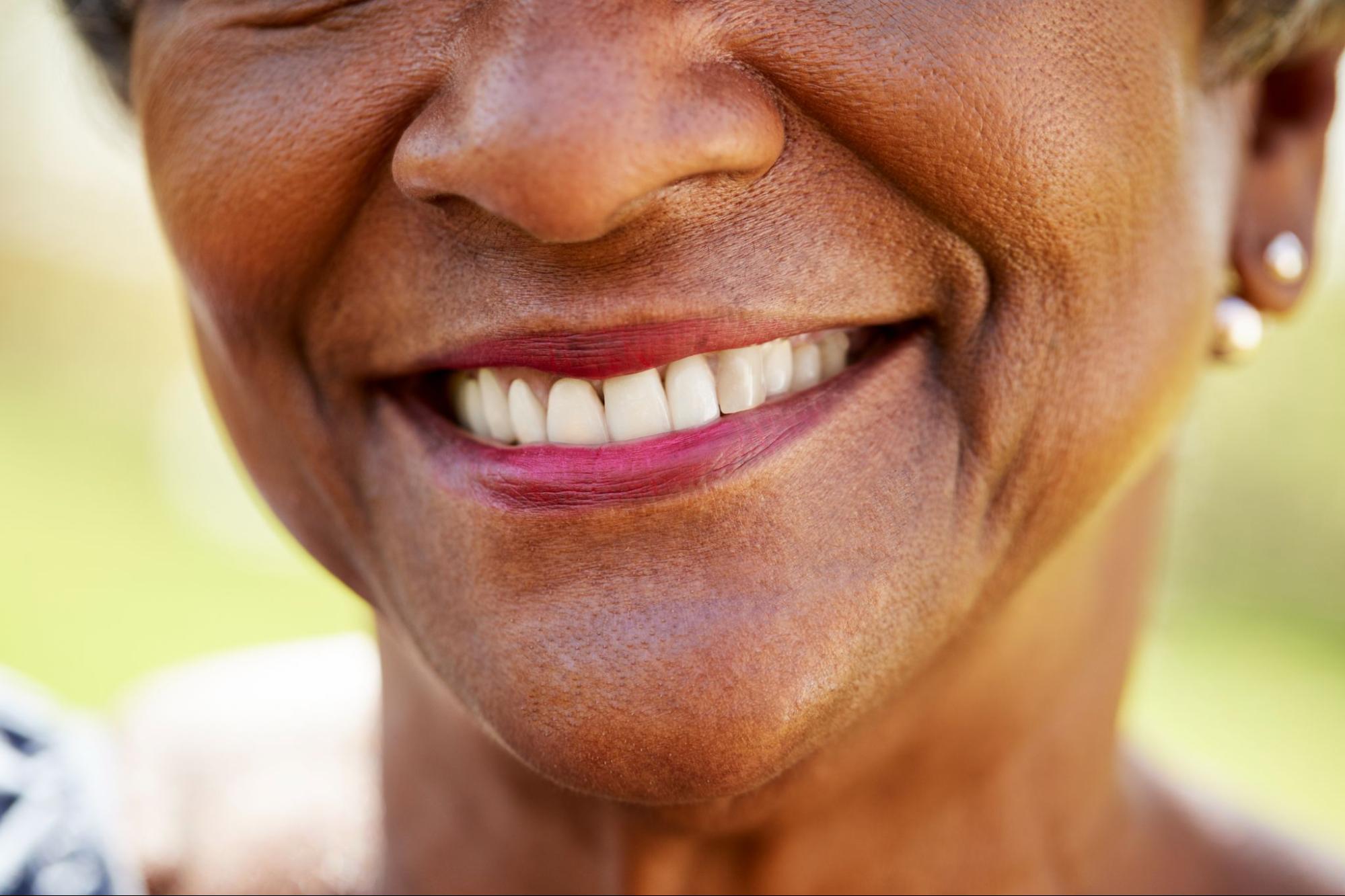 Older woman smiling with white teeth. 