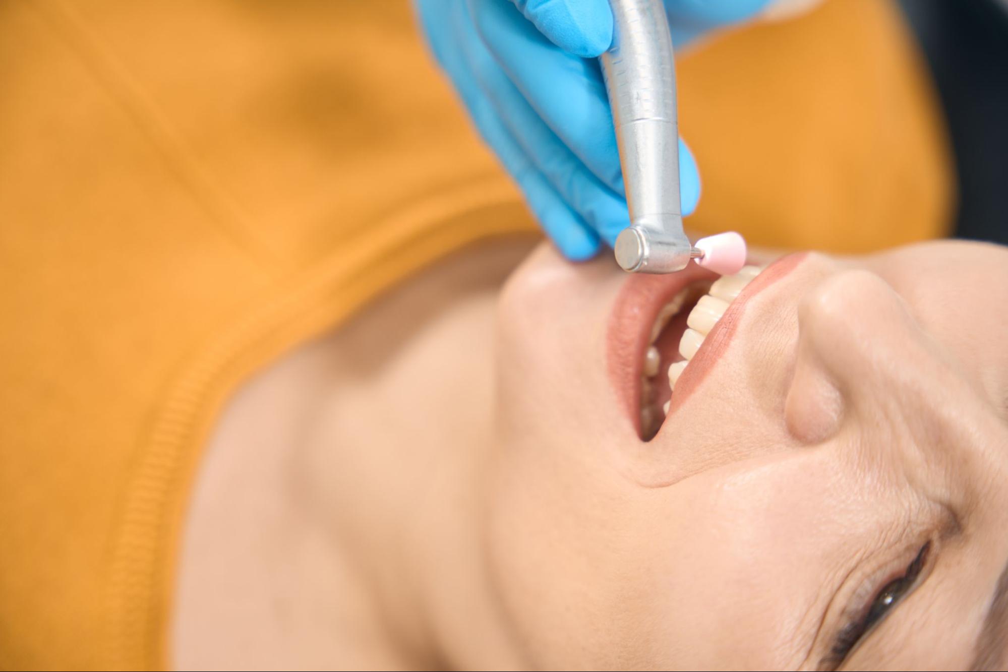 A close-up view of a hygienist using specialized tools to clean a female client's teeth, focusing on cleaning plaque off teeth.