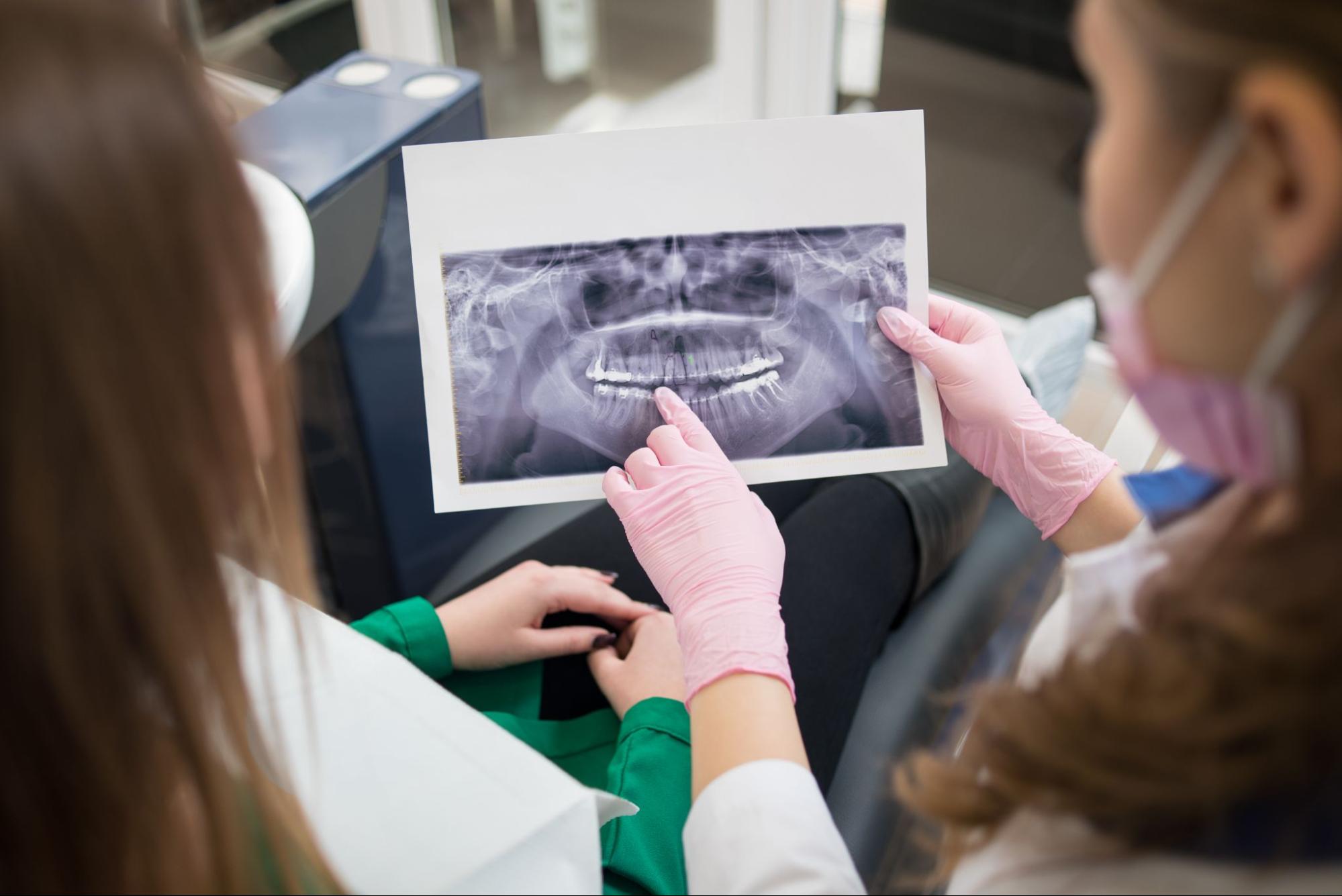 A view of a dentist and patient examining a teeth X-ray image.