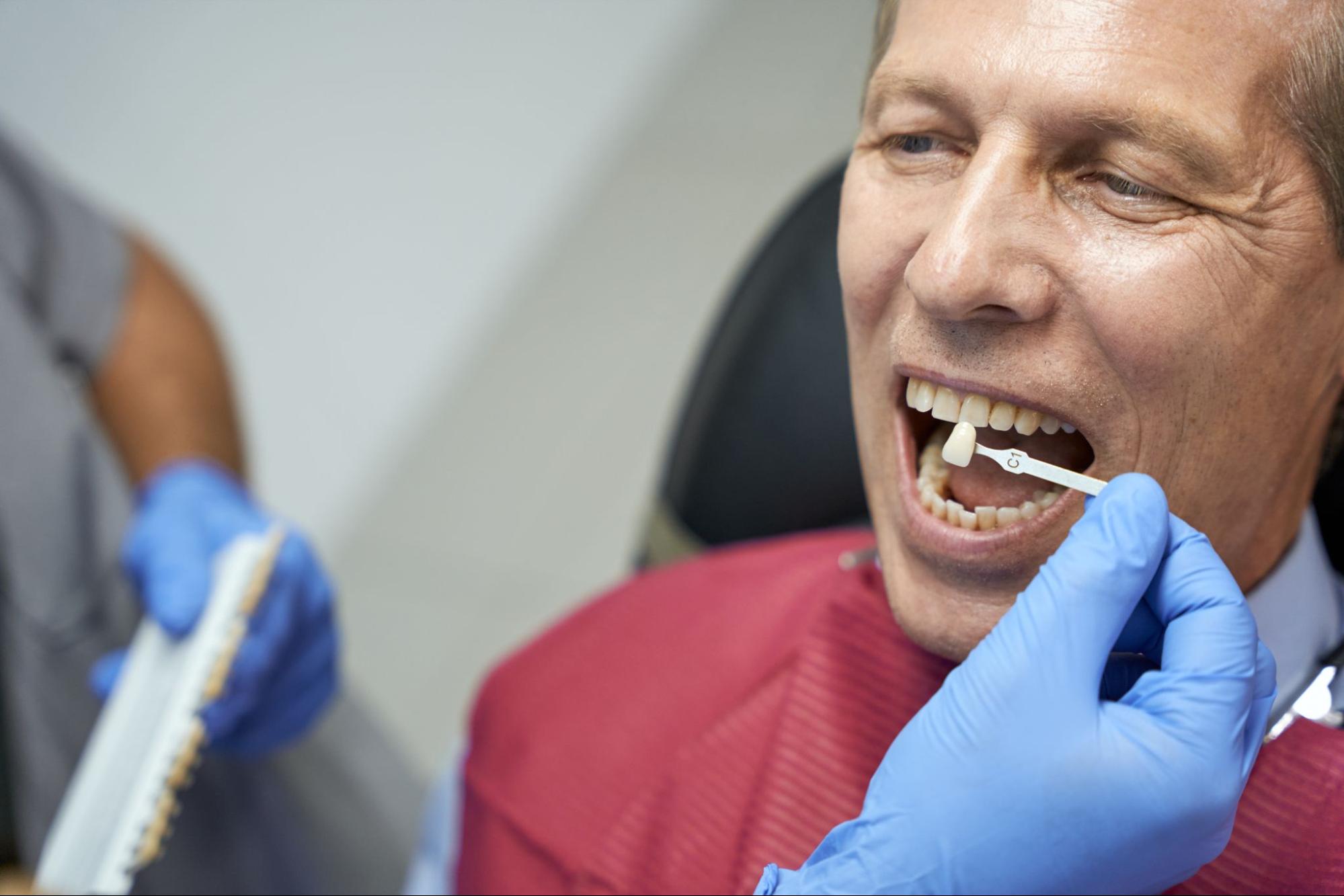 A dentist compares a crown sample to a male patient’s teeth during an emergency consultation for replacement options.